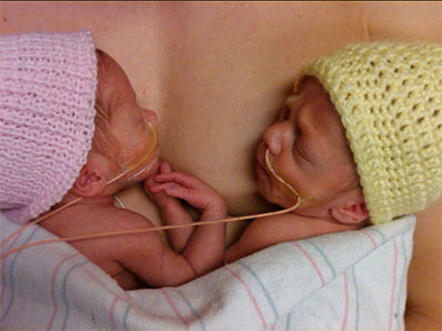 NICU - Lovell Twins